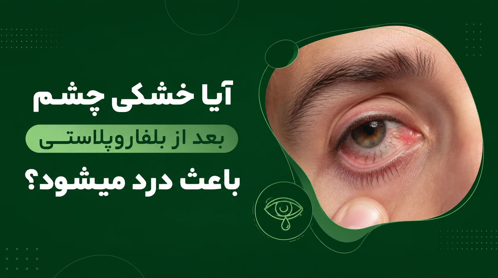 آیا خشکی چشم بعد از بلفاروپلاستی باعث درد میشود؟